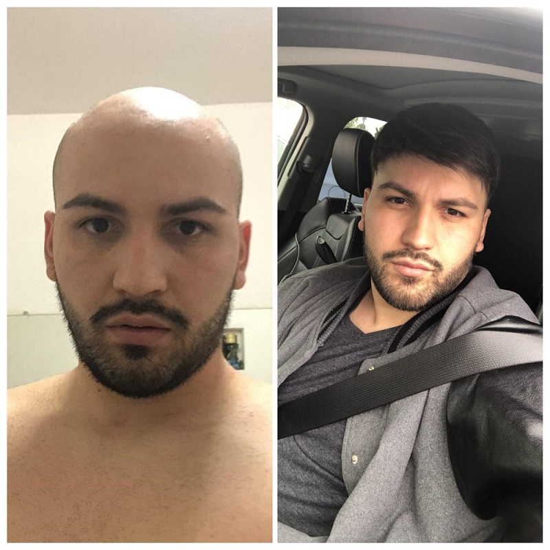 Mens wigs shop for baldness